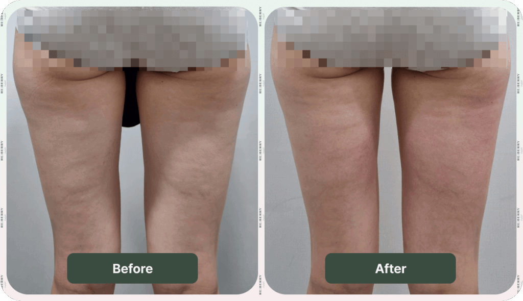 body treatment before and after