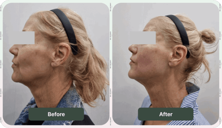 Myewing Leading Dermatology & Aesthetic Clinic in Myeongdong | Reberry