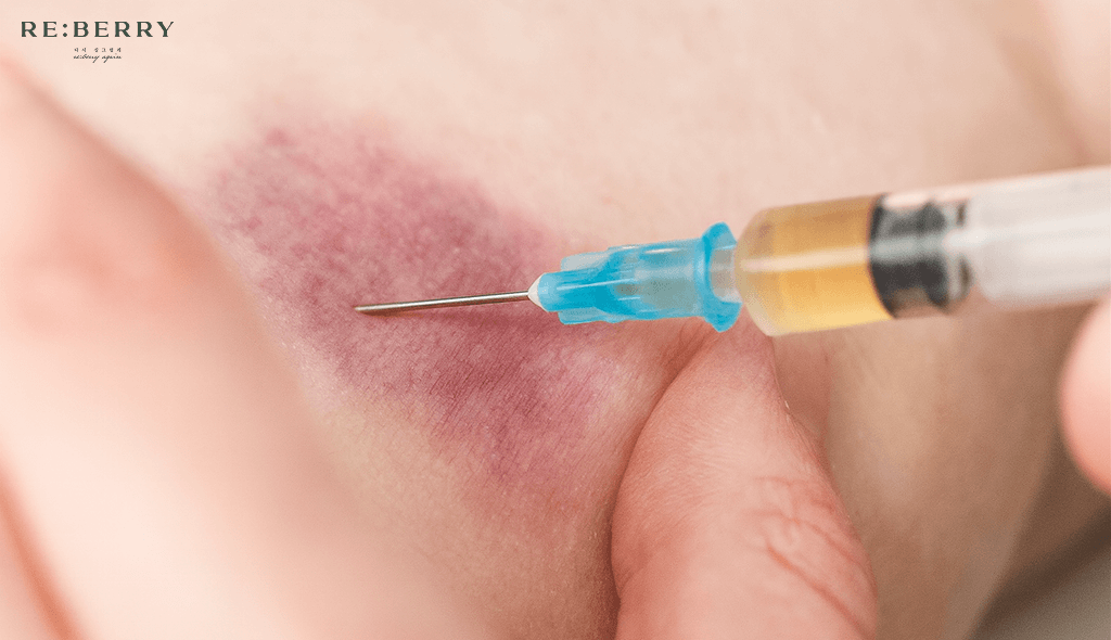 performing botox injection on skin with scar