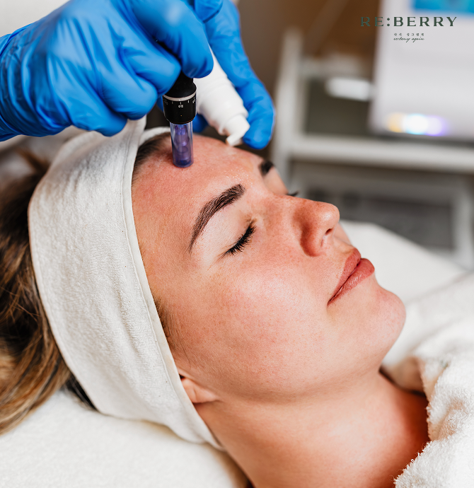 woman receiving microneedling treatment at a professional dermatology clinic