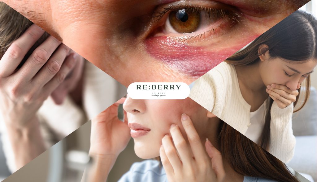 Collage showing common Botox side effects including bruising, eye irritation, and nausea