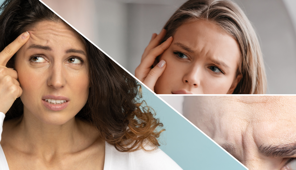 A collage of women showing forehead wrinkles, frown lines, and facial aging as signs of being a good Botox candidate