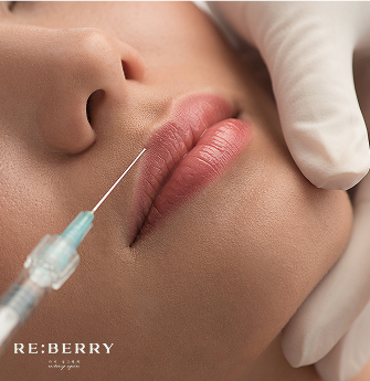 Close-up of a Botox lip flip injection being administered near the vermillion border of the upper lip