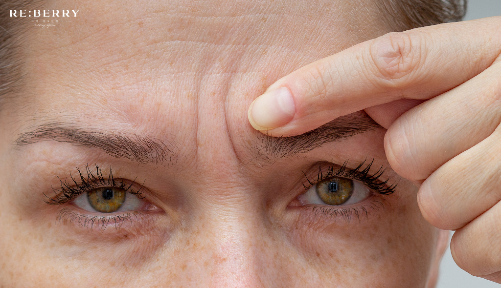 lines on a person forehead