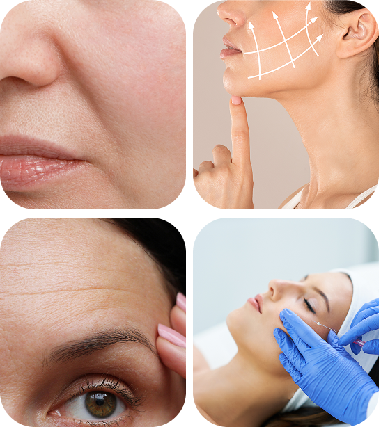 skin conditions thread lift is best for