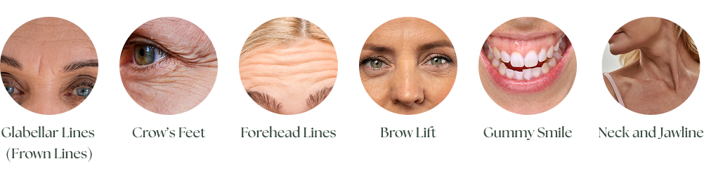 a image showing key areas to treat with botox after 50s