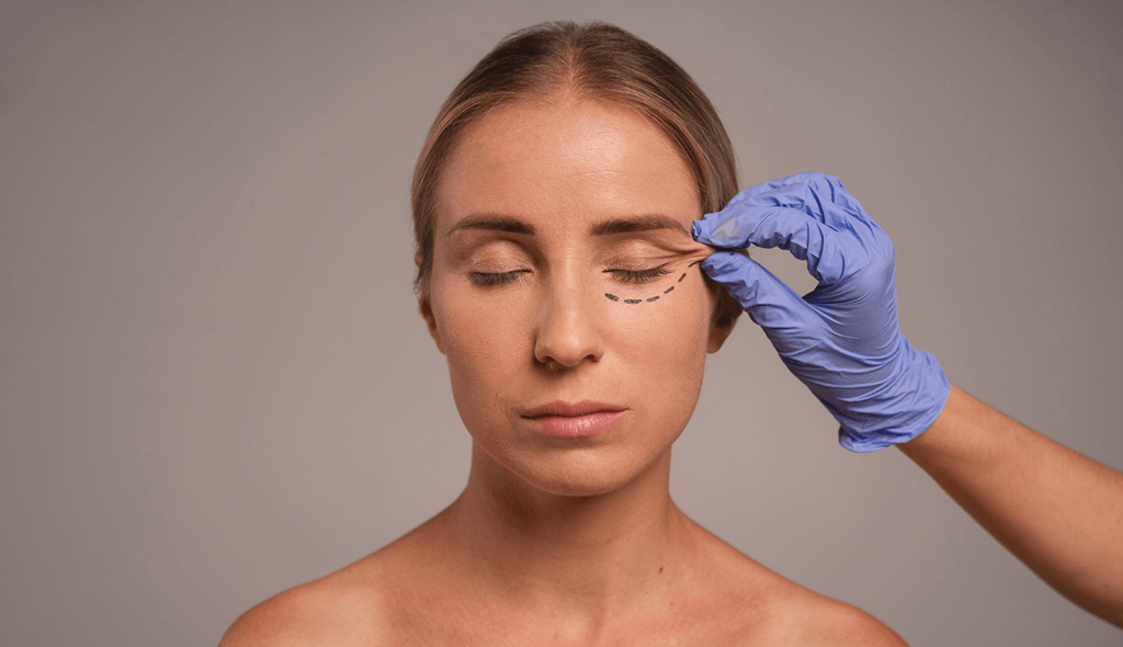 a woman having fox eye thread lift