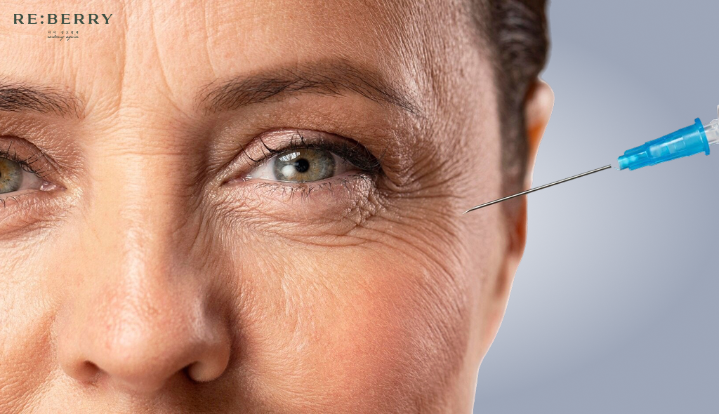 performing botox injection at eye wrinkles