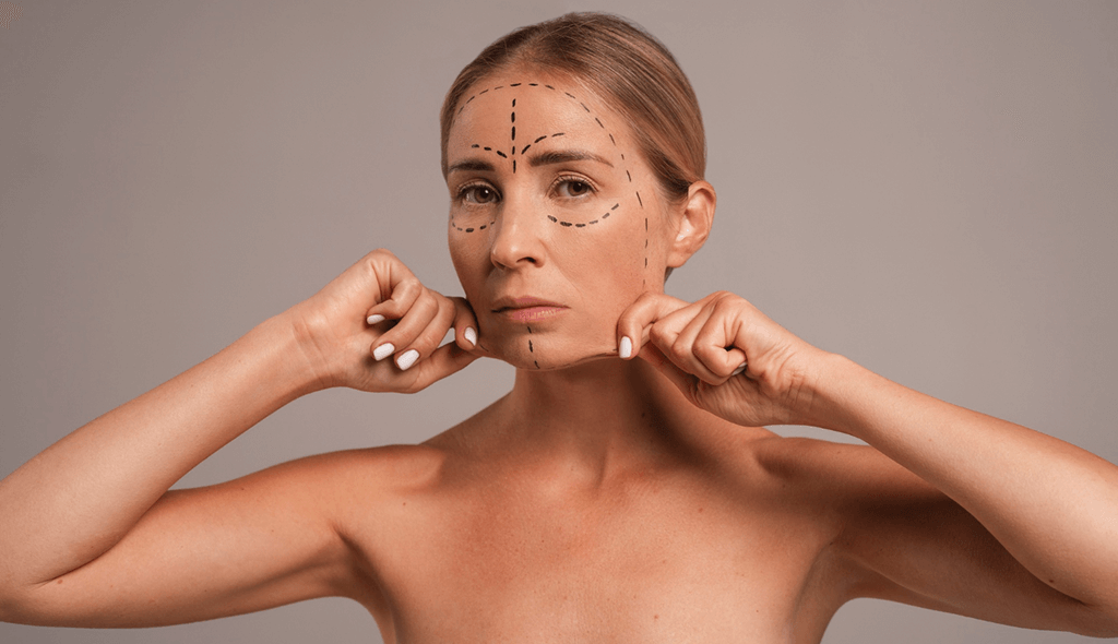 a women showing face with marks after thread lift failed